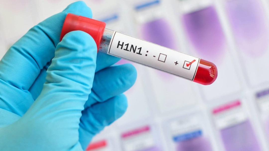 Հայաստանում H1N1 վիրուսից երկու մարդ է մահացել