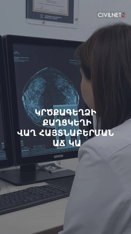 Հայաստանում կրծքագեղձի քաղցկեղի 4-րդ փուլում ախտորոշումը 40%-ից նվազել է մինչև 13%