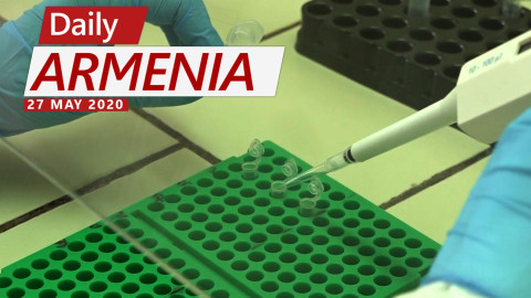 Armenia to Begin Production of 100,000 Covid Test Kits