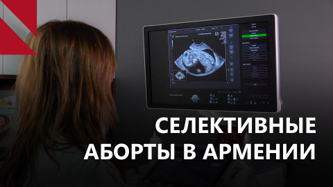 "Нежеланные дочери": проблема селективных абортов в армянском обществе