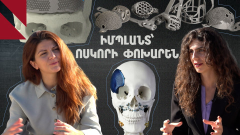 Իմպլանտ՝ ոսկորի փոխարեն. AIP TECH լաբորատորիայի պատմությունը