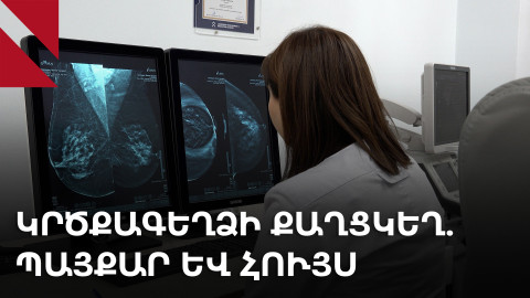 Ոչ մի հիվանդություն չի կարող ինձնից ուժեղ լինել. պայքարելով կրծքագեղձի քաղցկեղի դեմ 